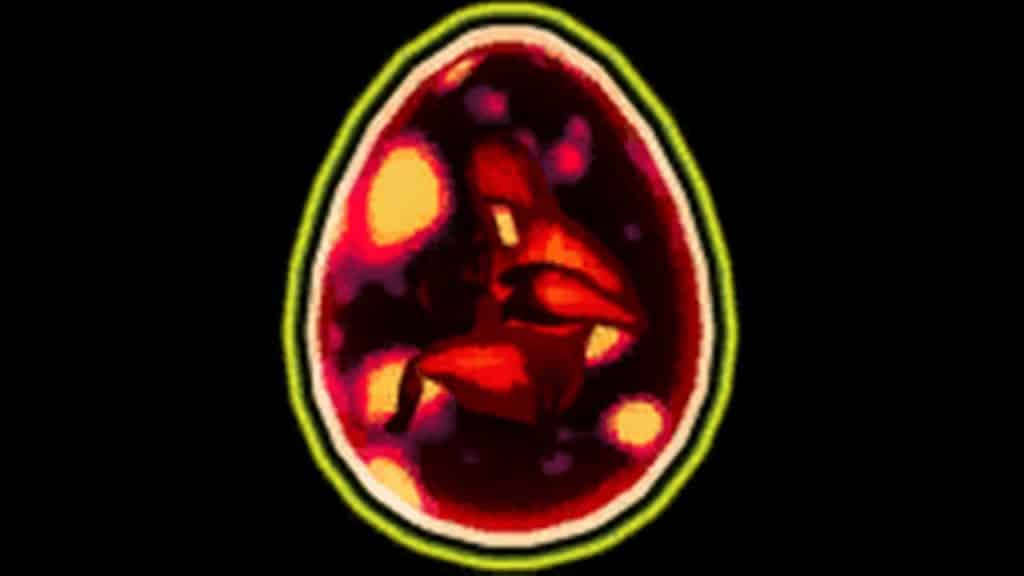 planula risk of rain 2