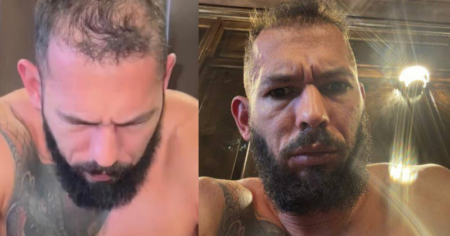 Andrew Tate Declines Medical Help as Unexplained Illness Causes Facial Swelling and Concerns of Poisoning Andrew Tate Poisoned